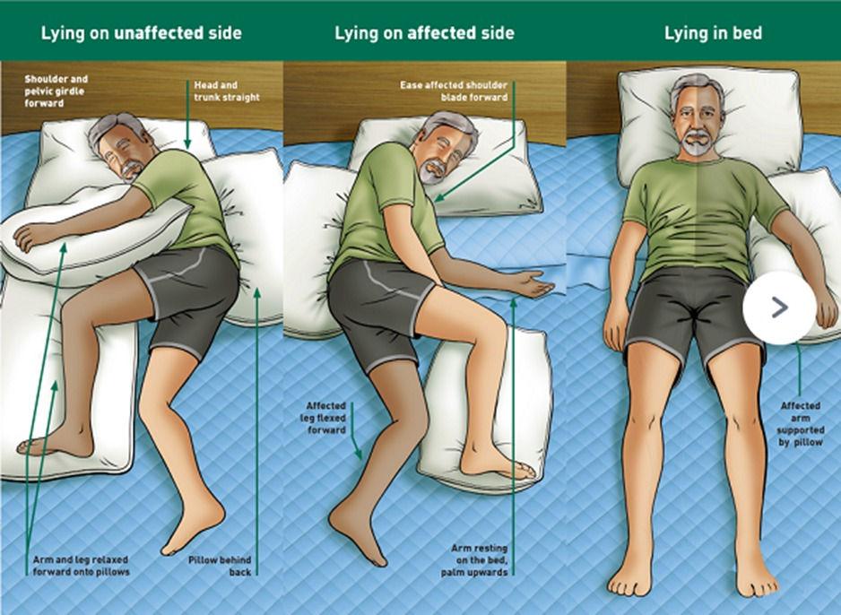 How to Improve Bed Mobility for Bedridden Patients: Tips by Physiotherapist
