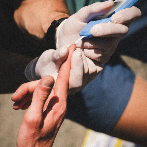 Lactate et endurance : comprendre son rôle pour mieux s’entraîner 🩸