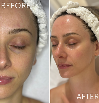 Before after minimal skincare Instagram post.png