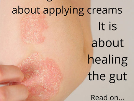 Eczema