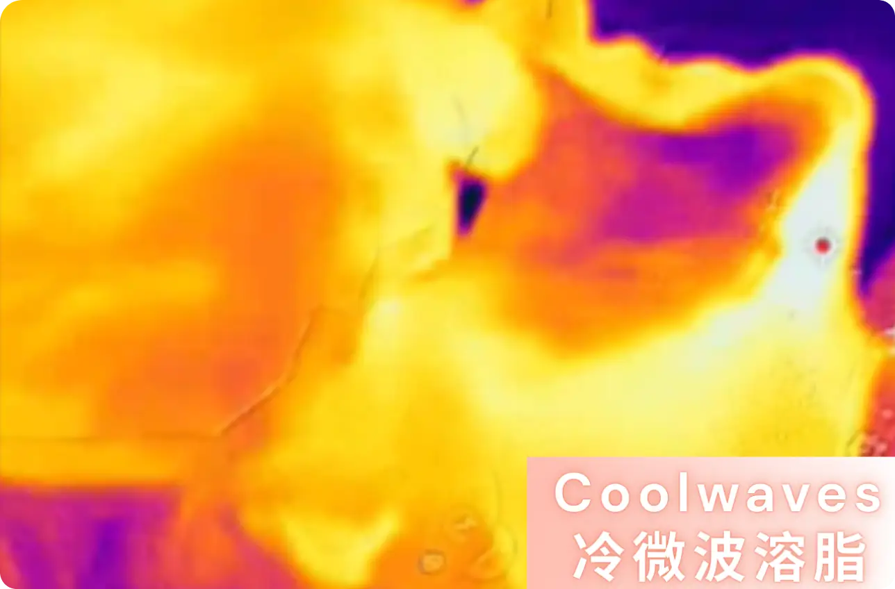 熱力R.webp