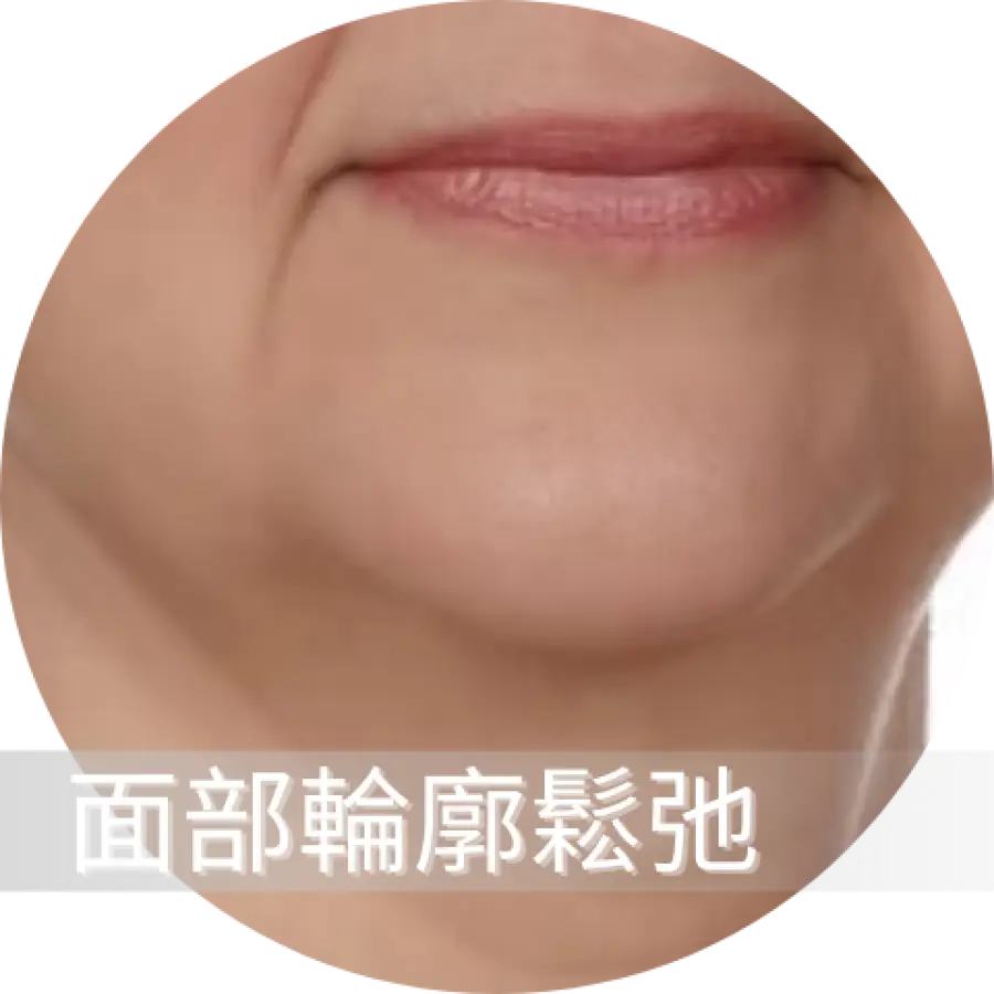 面部輪廓鬆弛.webp