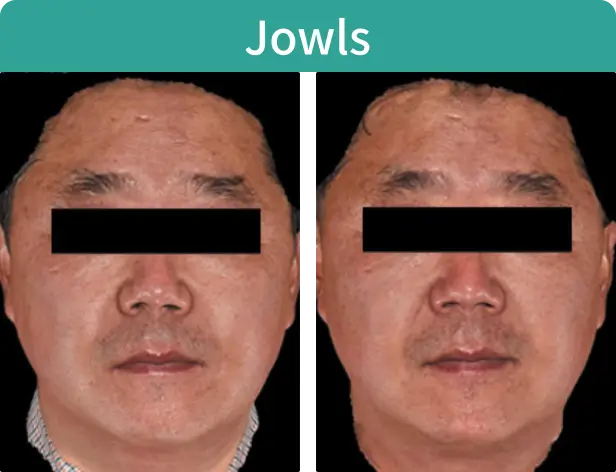 Jowls.webp