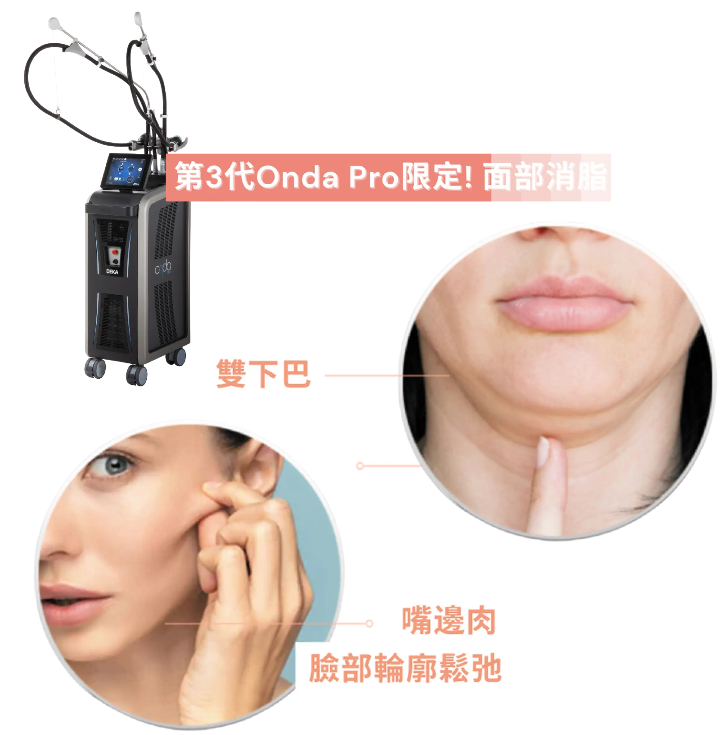 Onda Pro 一叮溶脂美容儀器與面部皮膚問題的示意圖，包括雙下巴和鬆弛肌膚的插圖。