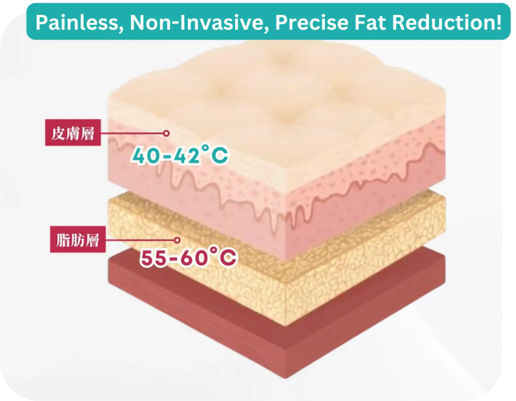 eng ver-Coolwaves™ 微波頻率:.webp