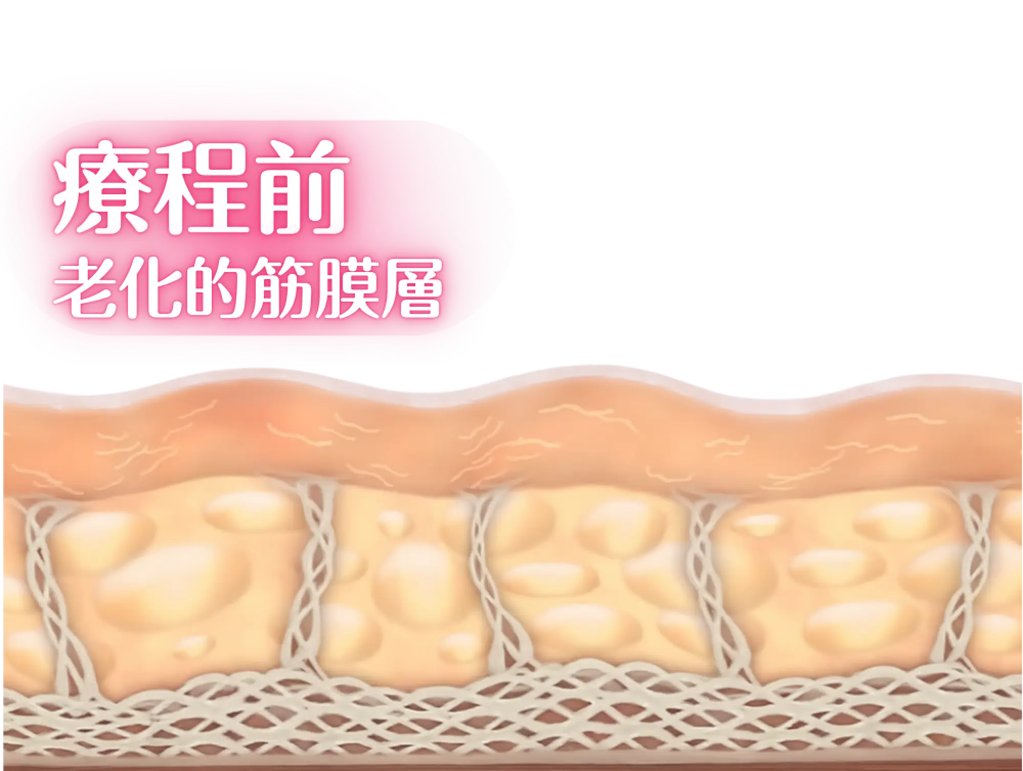 療程前.webp