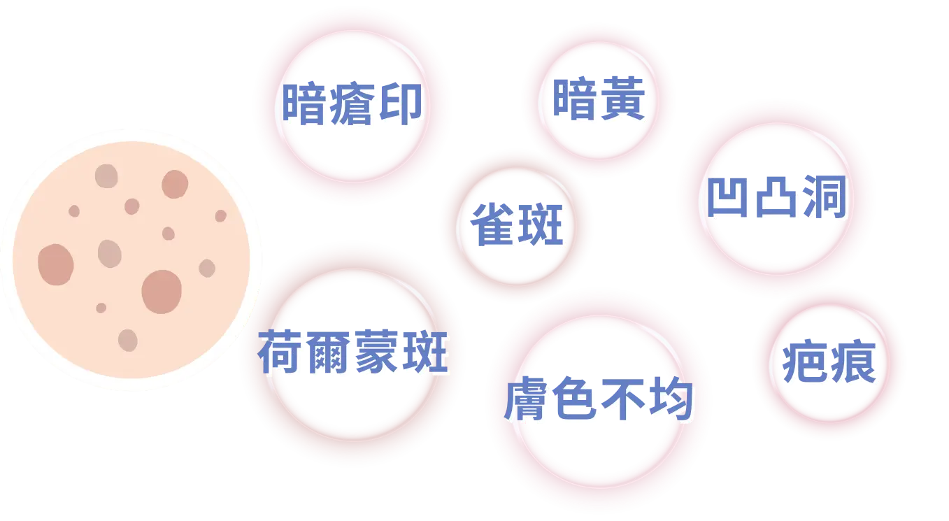 皮秒治療示意：一塊有斑點的皮膚圖，旁邊標示暗瘡印、暗黃、凹凸洞、痘痕、雀斑、荷爾蒙斑、膚色不均