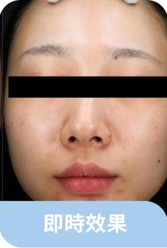 案例2-即時效果.webp