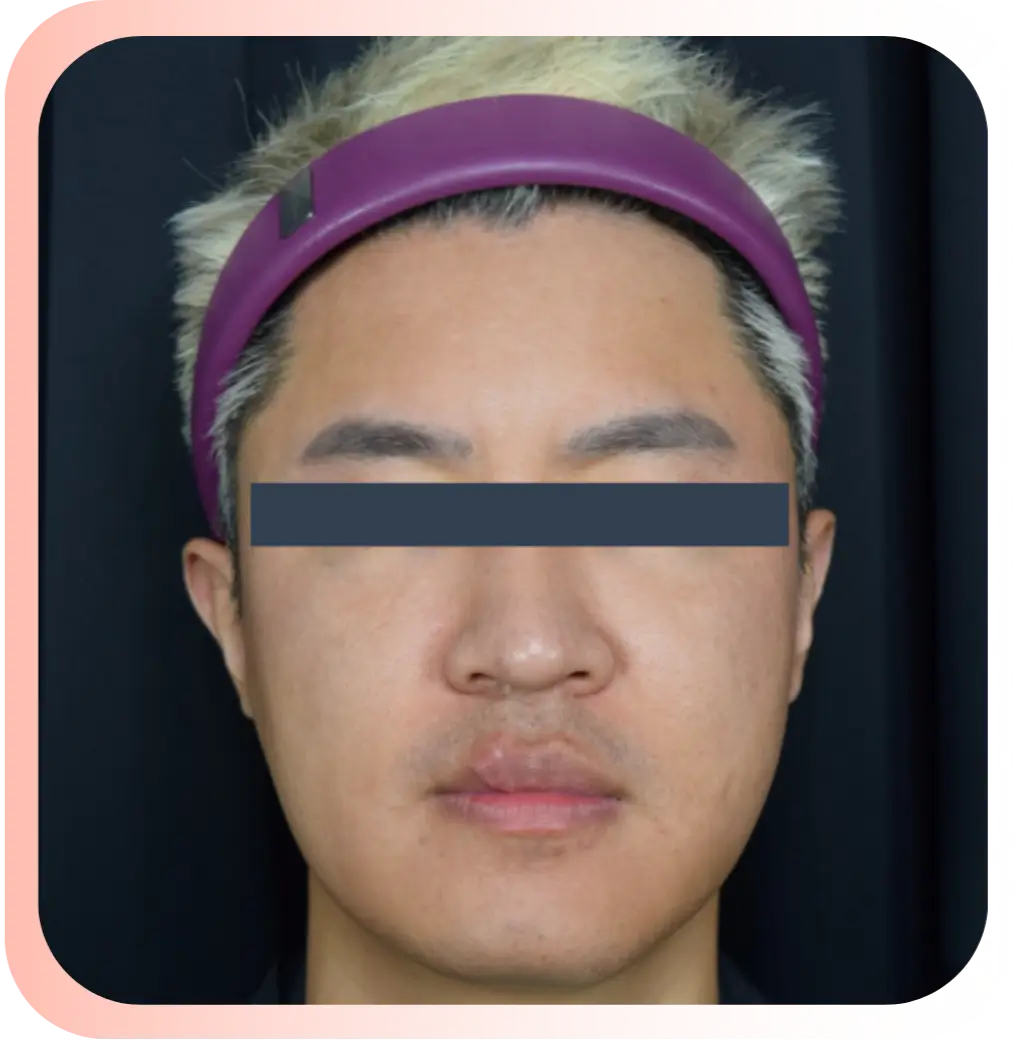 After-man.webp