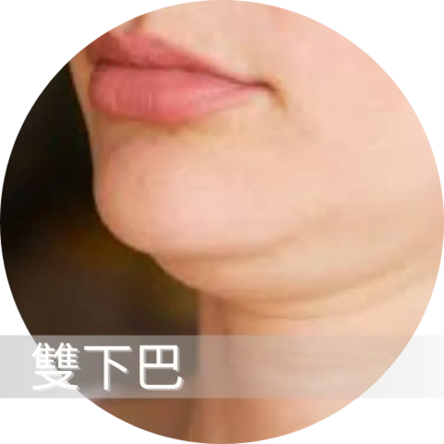 雙下巴.webp