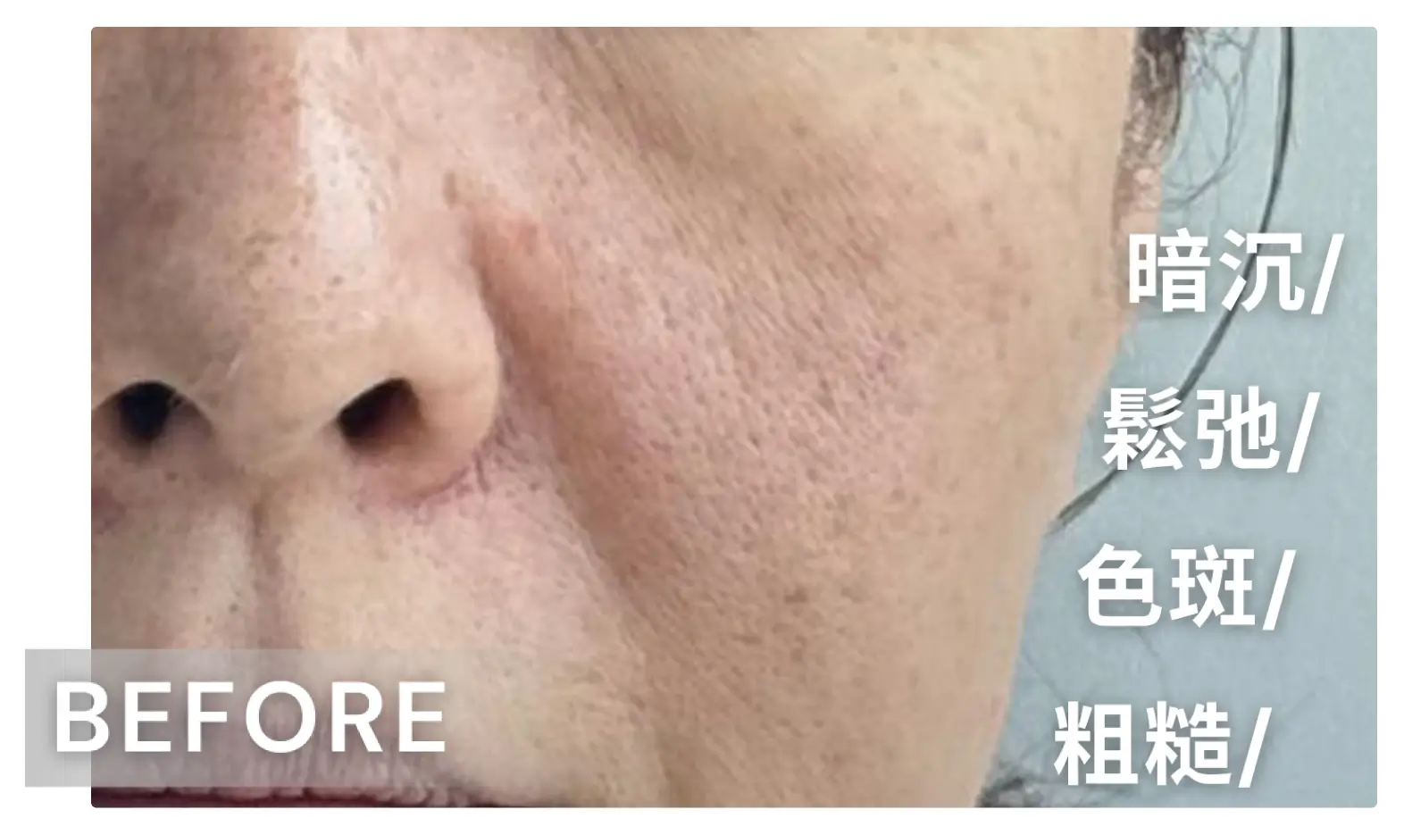 真實用家分享-before.webp