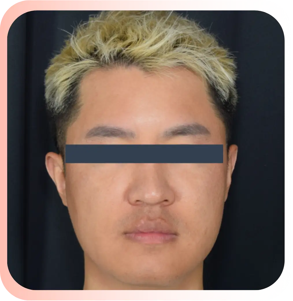 Before-man .webp