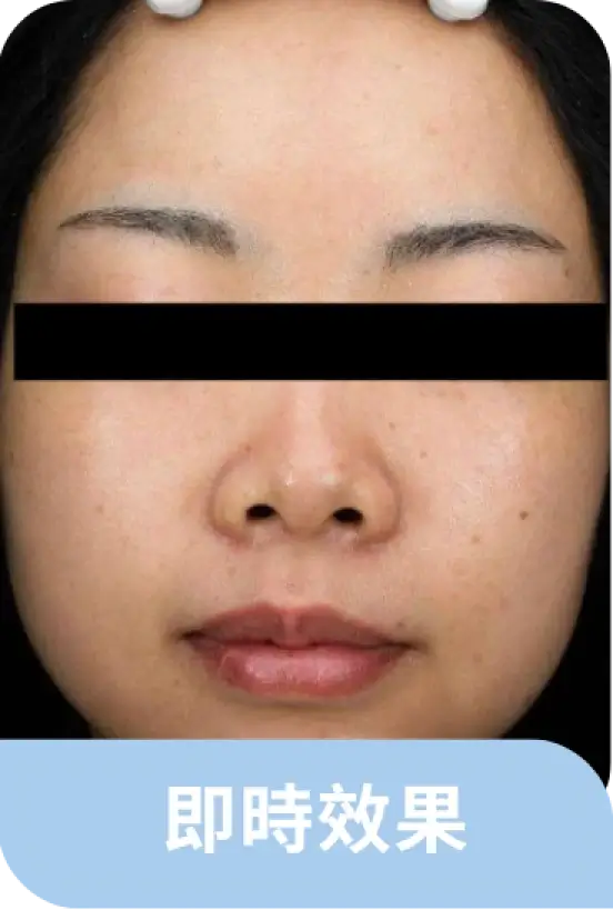 案例1-即時效果.webp