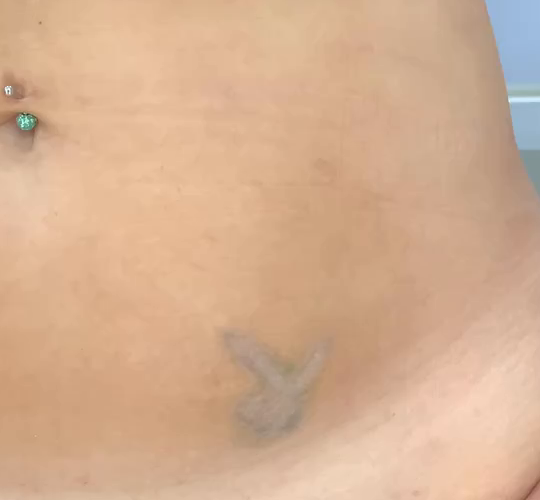 Small grey tattoo on the lower abdomen before the floral anchor cover-up