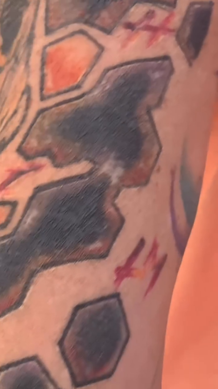 Antes del cover-up: motivos oscuros en la zona del brazo donde se realizarán las flores