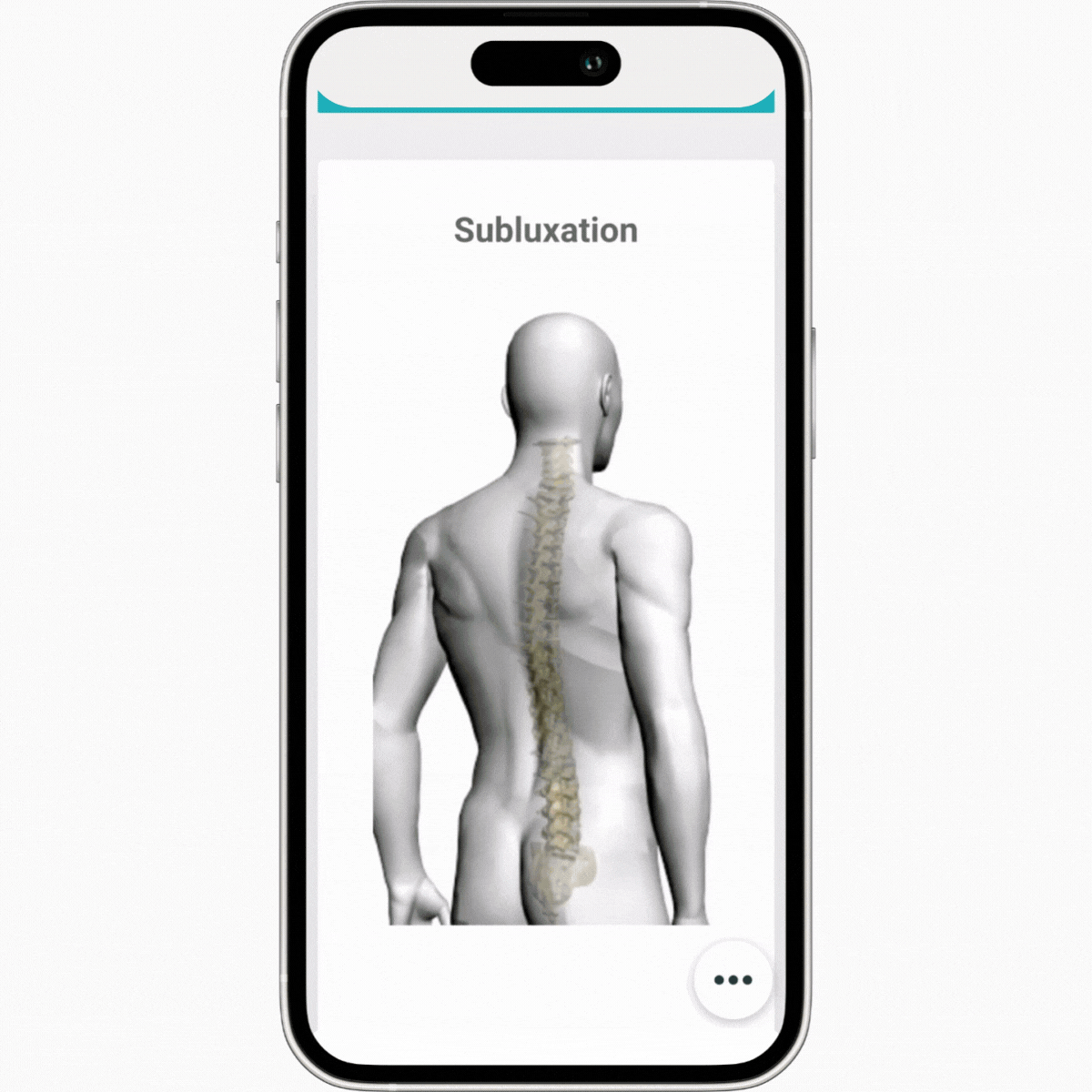 Spinal Diagram