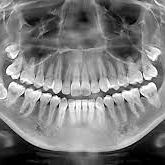 Dental Xray