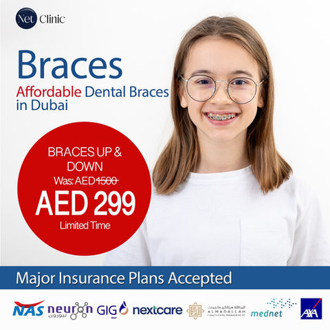 Braces Cost Dubai
