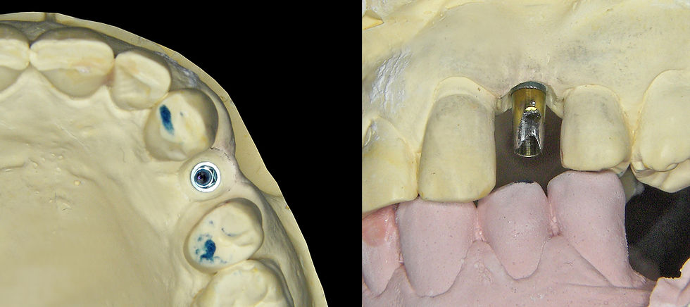 Image courtesy of: Dr. Guillermo Cabanes Gumbau