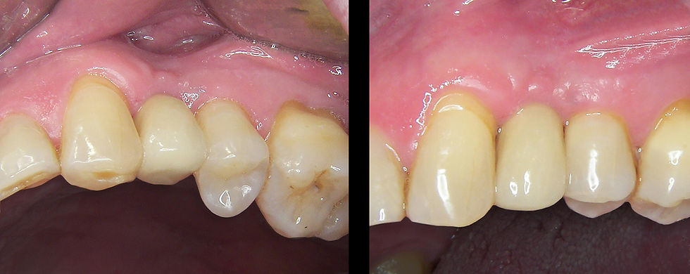 Image courtesy of: Dr. Guillermo Cabanes Gumbau