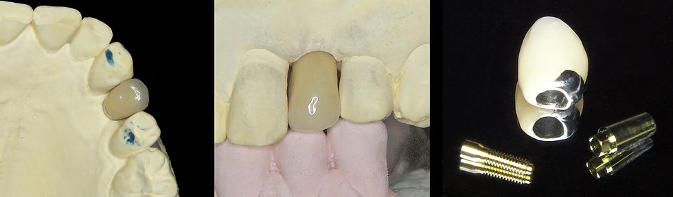 Image courtesy of: Dr. Guillermo Cabanes Gumbau