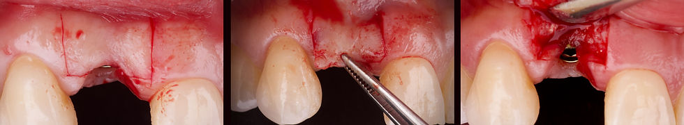 Foto per gentile concessione: Dott. Di Domenico