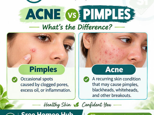 Best Homeopathy Clinic for Acne in Hyderabad