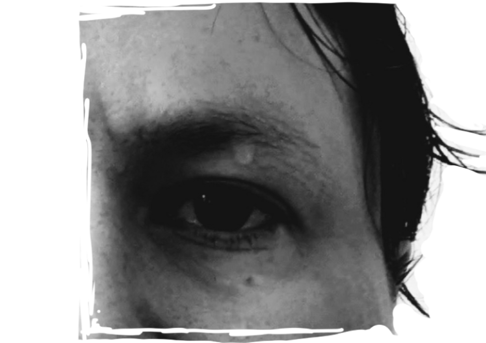 Close-up of the left eye.