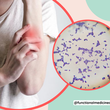 Signs of Candida Overgrowth in your body!