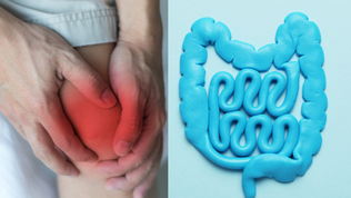Gut dysbiosis is one major cause of Gout