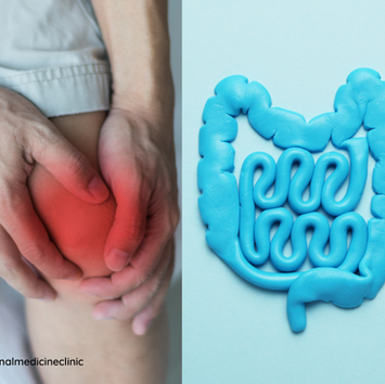 Gut dysbiosis is one major cause of Gout