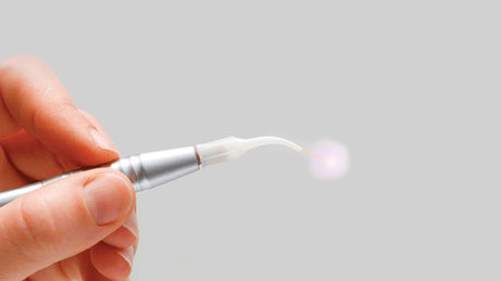 SWEEPS Endodontic Laser - State of the Art Laser Root Canal Treatment.