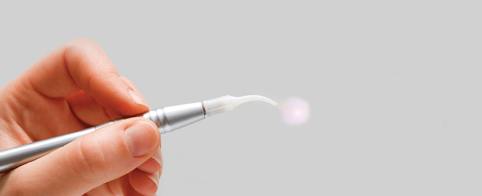 SWEEPS Endodontic Laser - State of the Art Laser Root Canal Treatment.