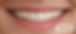 after.PNG