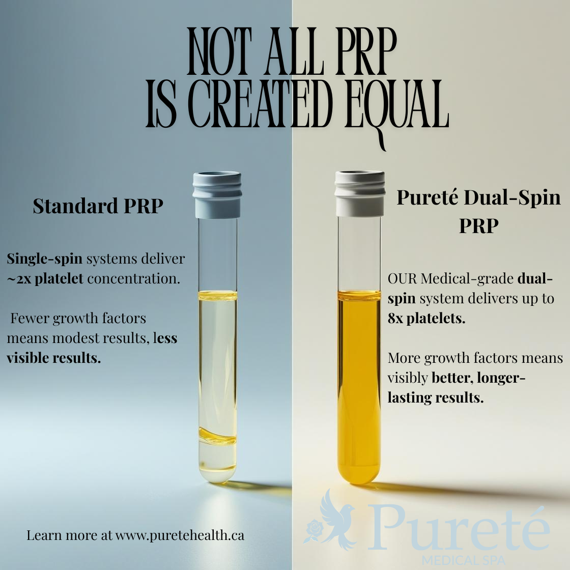 Pureté dual-spin PRP test tubes showing higher platelet yield than standard PRP