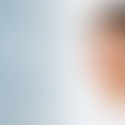 Potenza vs Morpheus8: Why Potenza Is the More Complete RF Microneedling Treatment