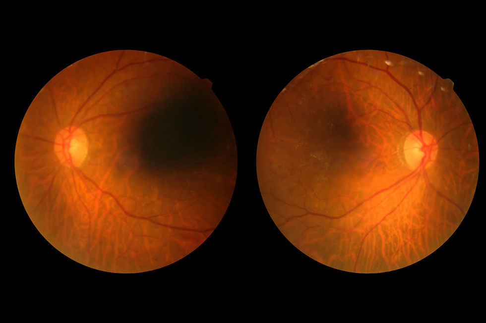 š Your Vision Could Be Sending a Warning You Can't See