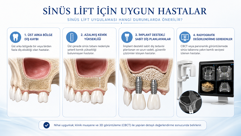 Sinüs lifting için uygun hastalar