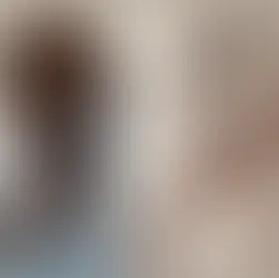 Transmedicalismo ou transmed: barreiras à inclusão e à diversidade Trans