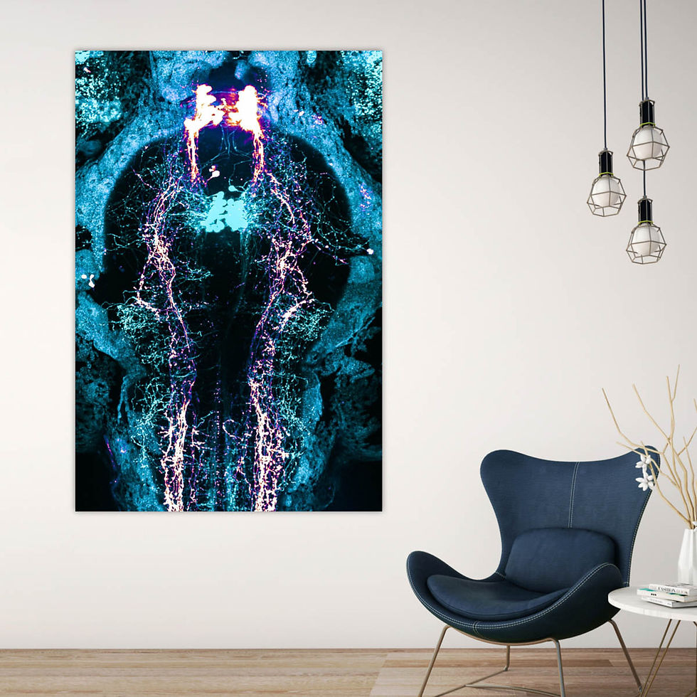 Miniature : Neurones en Lumières II, Claire Wyart et Martin Carbo-Tano