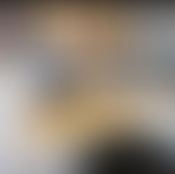 SUP효과 검증을 위한 임상연구 시작