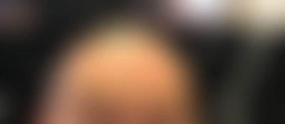 Der Glatzkopp ist zurück bei KAO