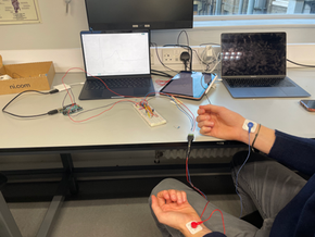 ECG Design Using Arduino