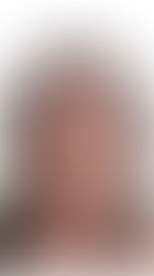 Deixar de Fumar com o Choque na Orelha®️