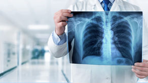 Enfisema Pulmonar: Causas, Sintomas e Tratamentos Eficazes