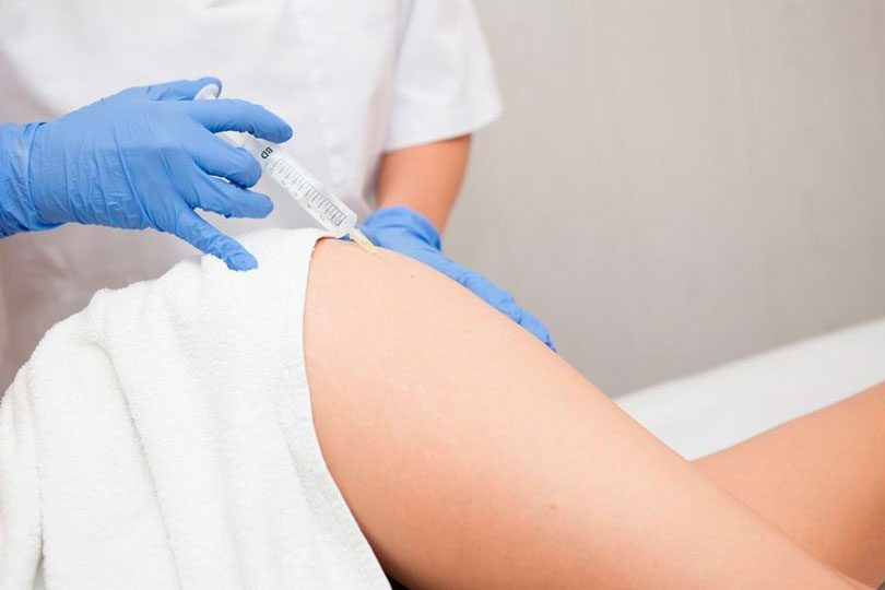 Mesoterapia para a Celulite