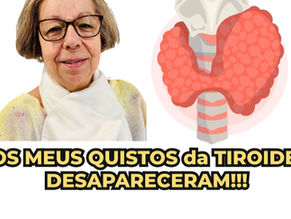 Testemunhos de Biofeedback: Os meus Nódulos da Tireoide desapareceram!