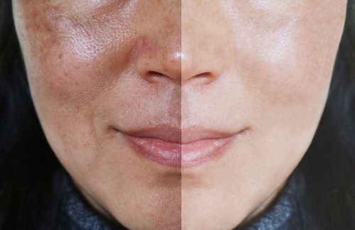 PhotoFacial