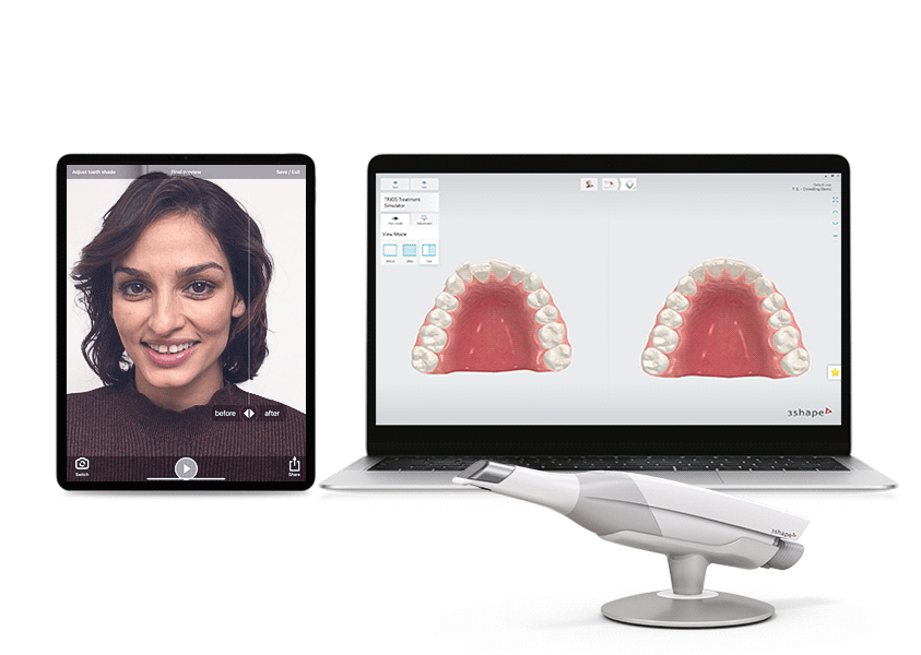 before-after scan patient gif.gif