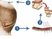 Follicular Unit Transplantation (FUT): 2024 Clinical Guidelines to Maximize Yield & Minimize Risk 